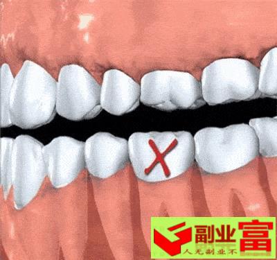 牙齿的治疗方法有几种图片（牙齿松了，苦不可言！6个方法对症下药）-副业富