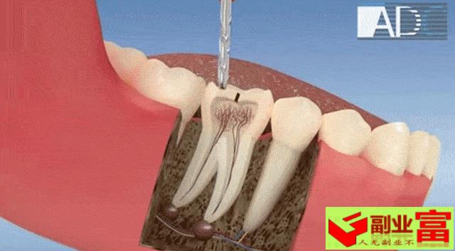 牙齿的治疗方法有几种图片（牙齿松了，苦不可言！6个方法对症下药）